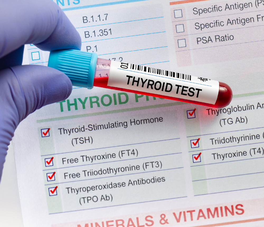 Blood tube test with requisition form for Thyroid gland test.